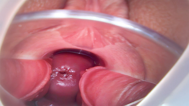 4 Orgasms with Speculum Cervix View video from Adulting