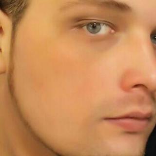 Ardox photo