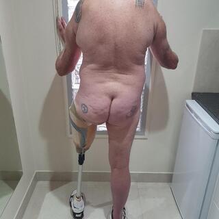 Bi Amputee Slut photo