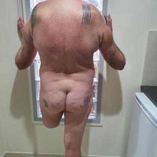Bi Amputee Slut photo