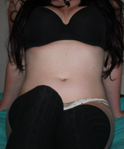 bitesnbruises at APClips.com