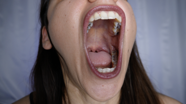 Wide Open Mouth Fetish video from Easy Andy