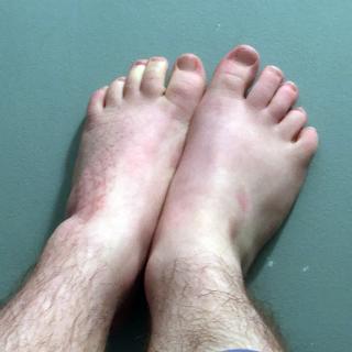 tiny trans boy feet photo gallery by Teddy Behr