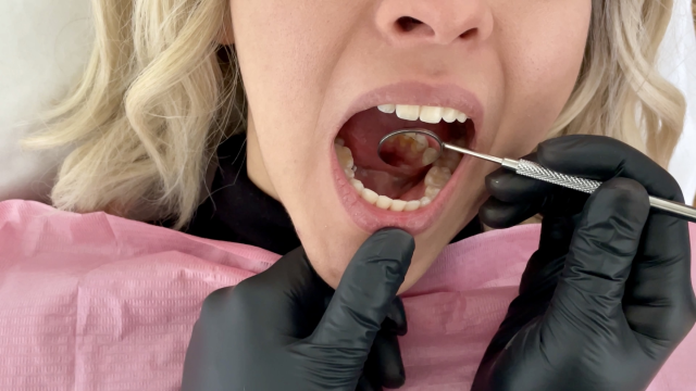 Dental Cleaning - Full Mouth and Permanent Retainer video from Kim And Vivi