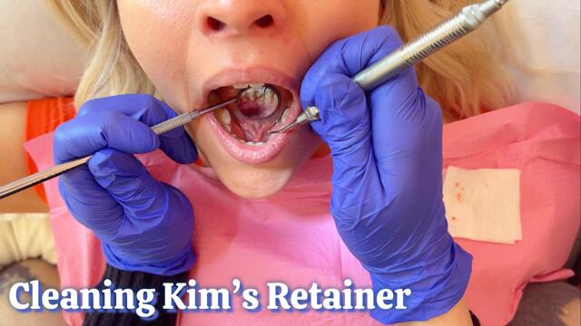 Kims Mouth Tour, Dental Cleaning, and Retainer Scraping video from Kim And Vivi