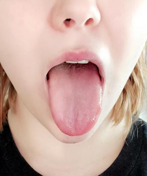 Invadernoodles contest photo