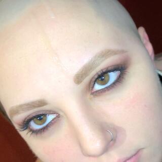 Bald Bratty photo