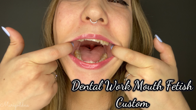 Dental Work Mouth Fetish Custom video from Marigoddess