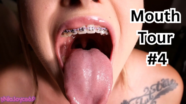 Braces Mouth Tour 4 video from Milajoyce69