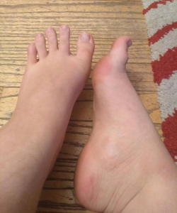 Toebin at APClips.com