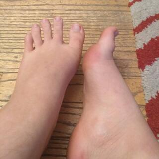 Toebin photo