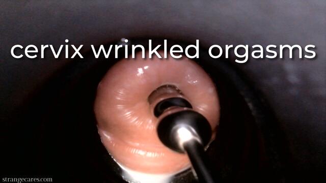 cervix wrinkled orgasms video from Strangecares